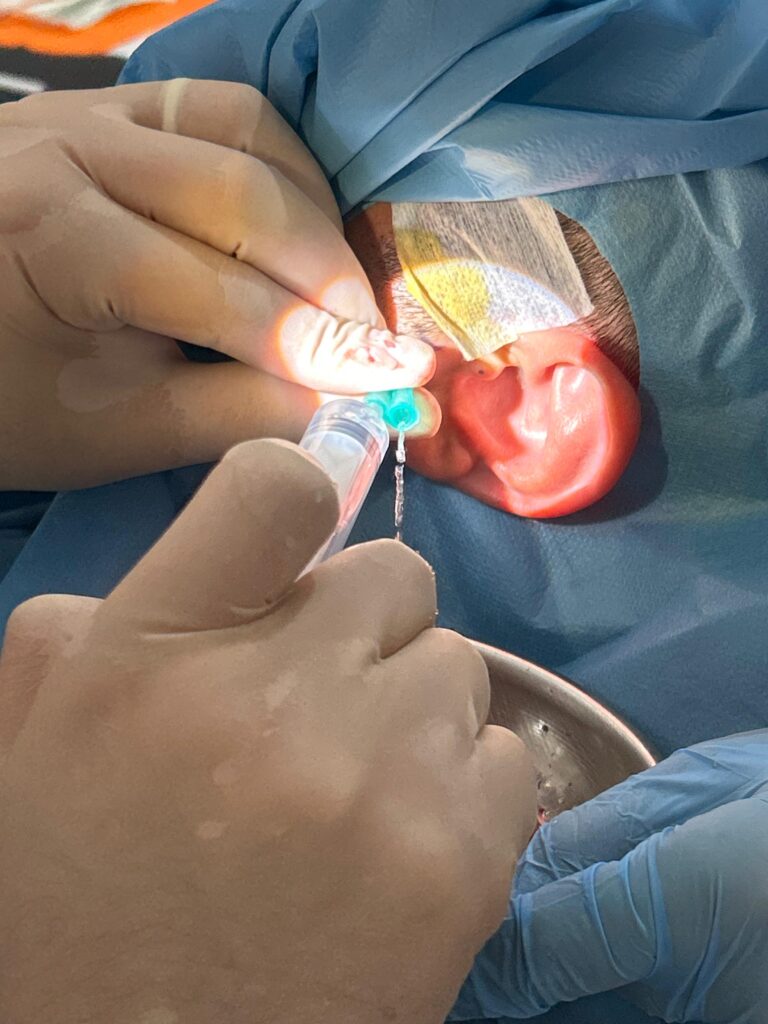 TMJ Arthrocentesis Turkey