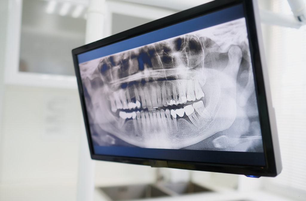 Consulta en línea ATM