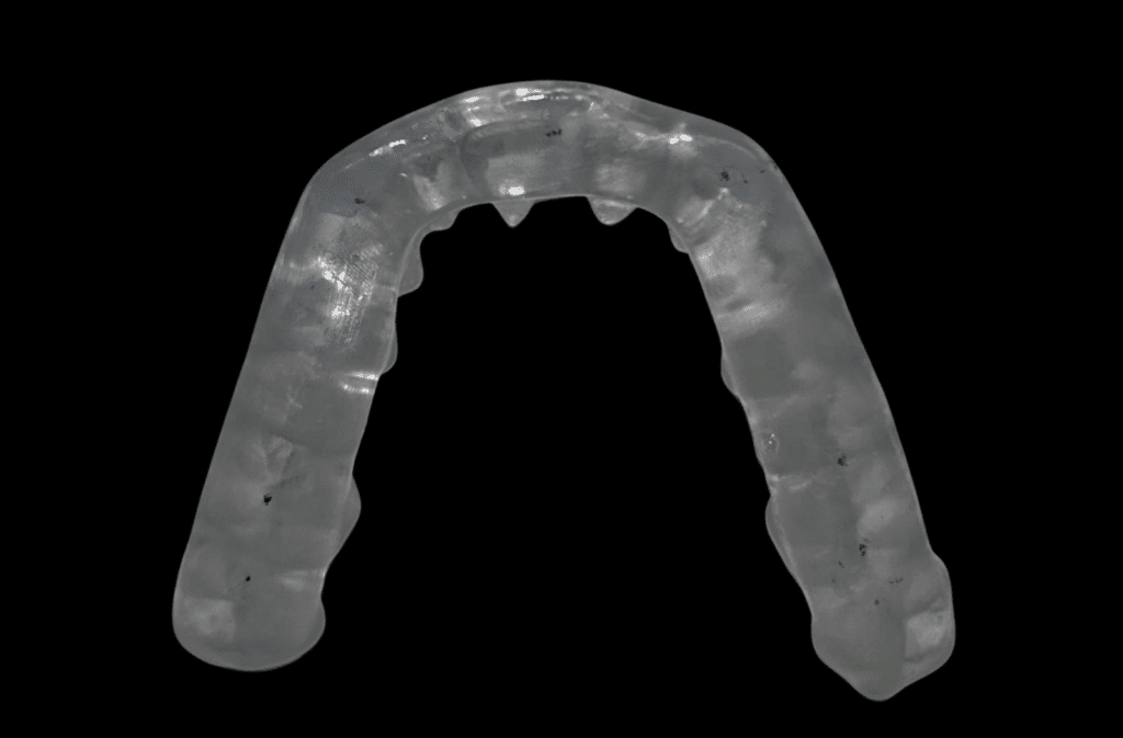 TMJ Splint Treatment
