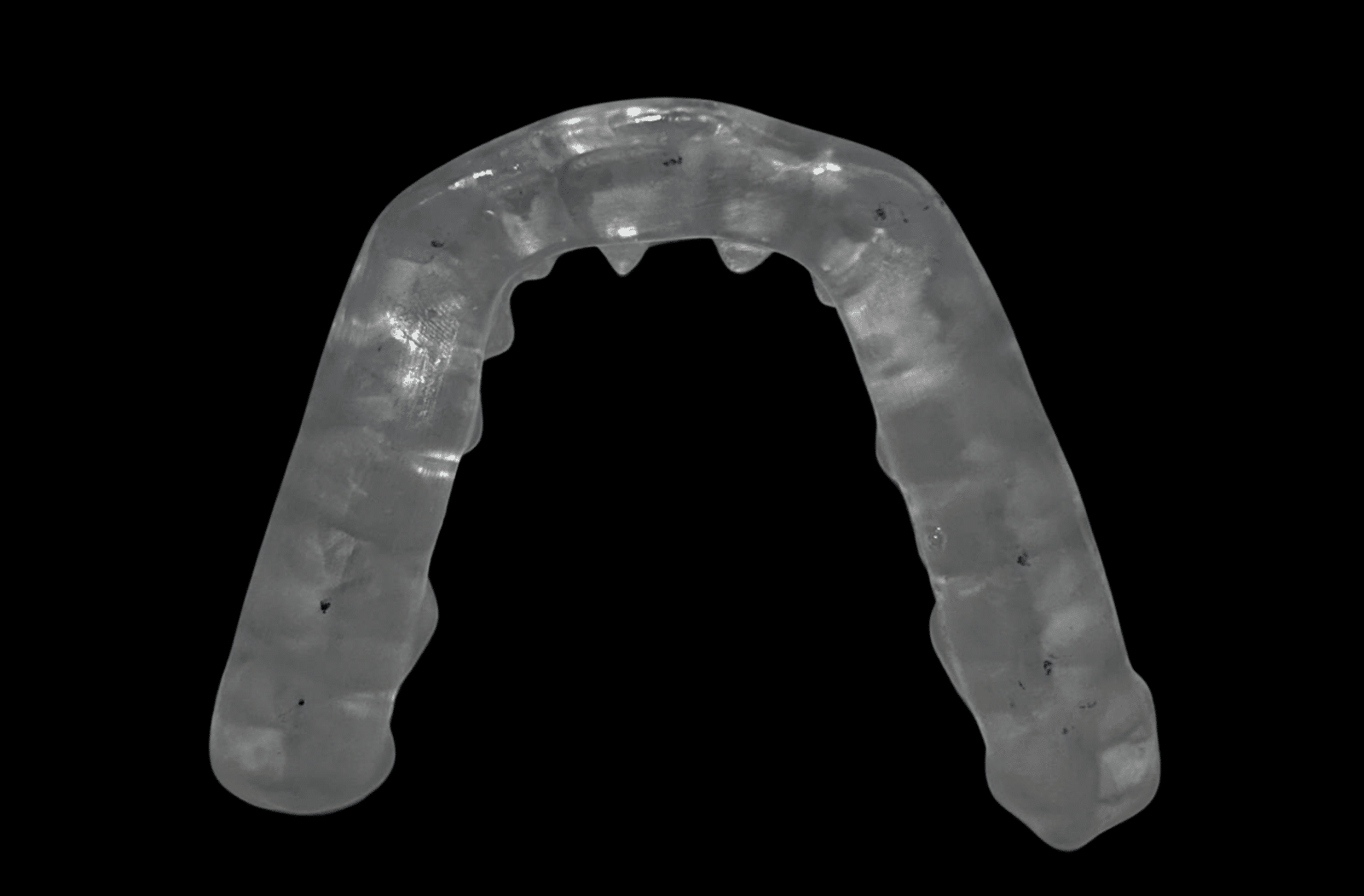 TMJ Splint Treatment